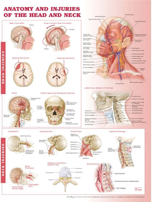 Anatomy and Injuries of the Head and Neck Anatomical Chart 6706
