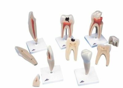 Classic Tooth Model Series D10 1