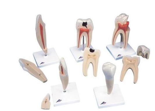 Classic Tooth Model Series D10