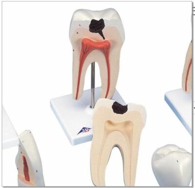 Classic Tooth Model Series D10 3