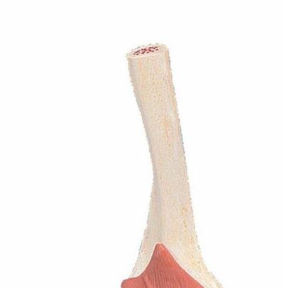 Deluxe Functional Elbow A83/1 2
