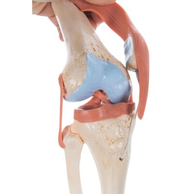 Deluxe Functional Knee A82/1 2