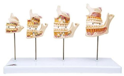 Dentition Development D20