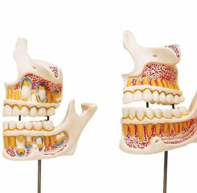 Dentition Development D20 3