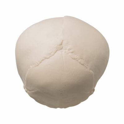 Foetal Skull  A25 4
