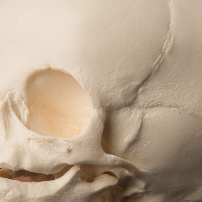 Foetal Skull  A25 2