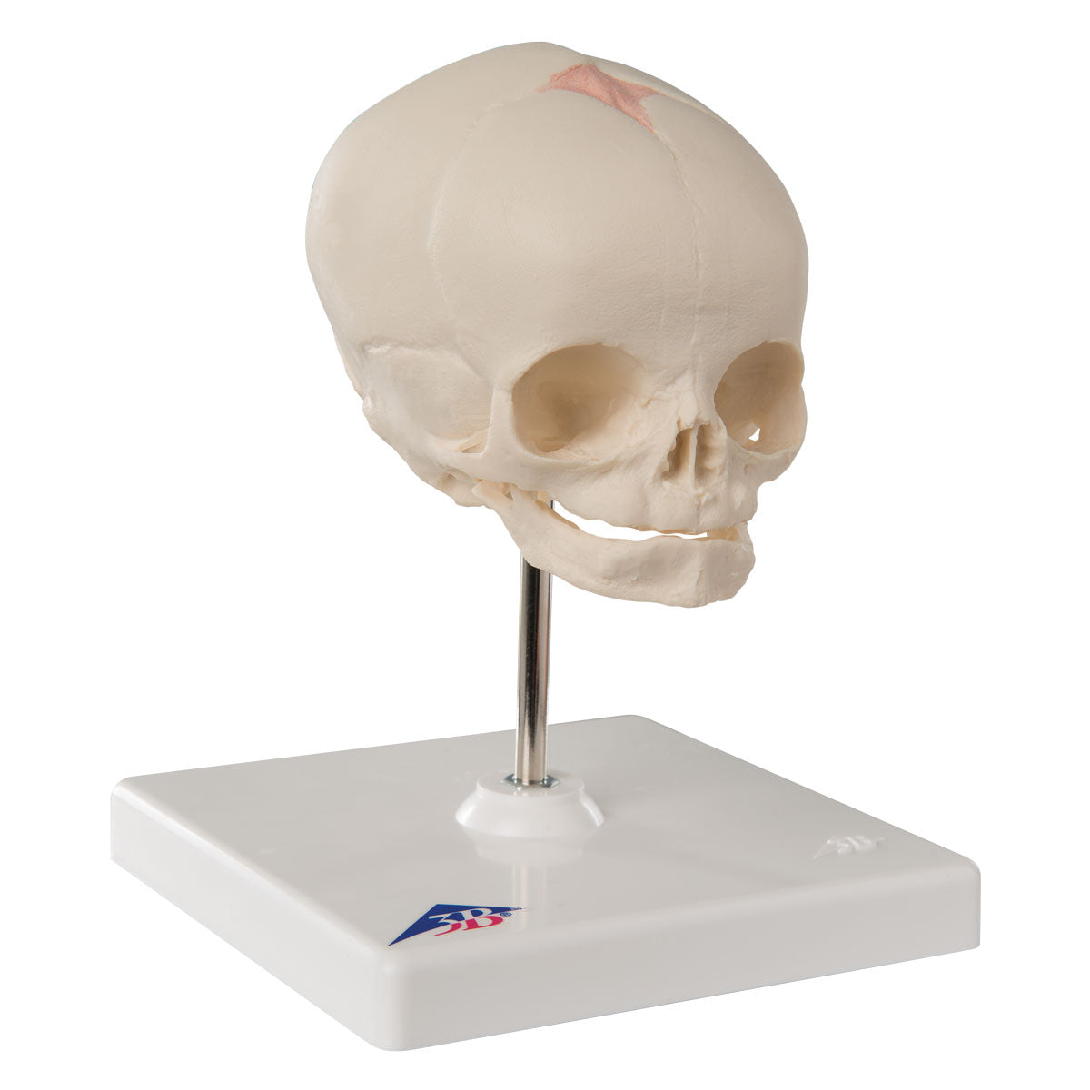 Foetal Skull on Stand  A26