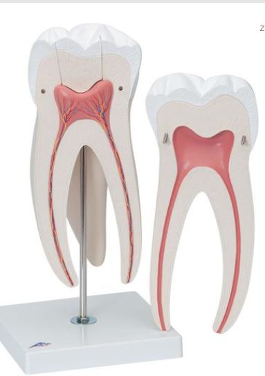 Giant Molar with Dental Caries D15 1