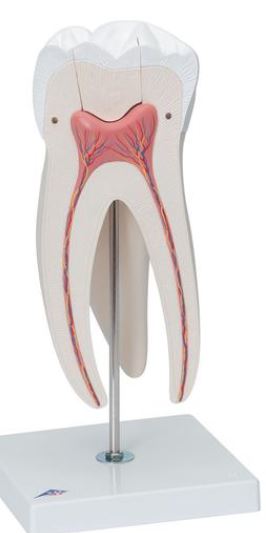 Giant Molar with Dental Caries D15 5
