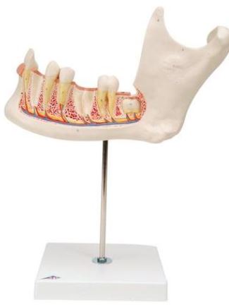 Half Lower Jaw, 3 times D25 1
