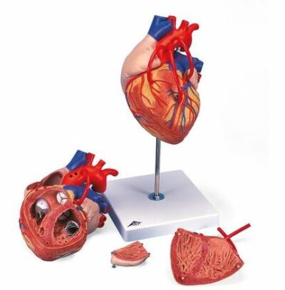 Heart with Bypass – 2times Life S – 4 Part G06 1