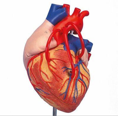 Heart with Bypass – 2times Life S – 4 Part G06 2