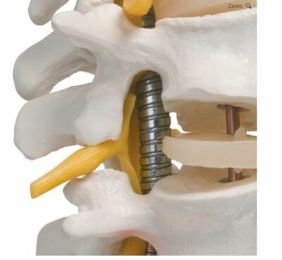 Highly Flexible Spine  A59/1 2