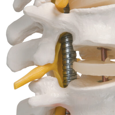 Highly Flexible Spine A59/2 4