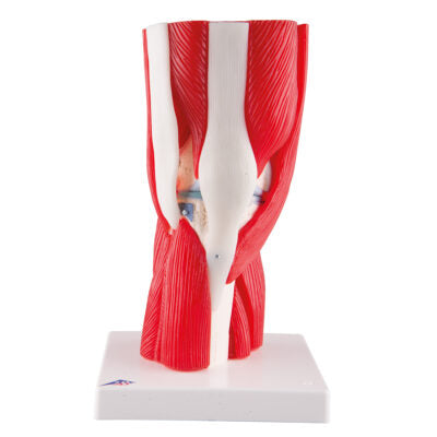 Knee  Joint  12-Part A882 1