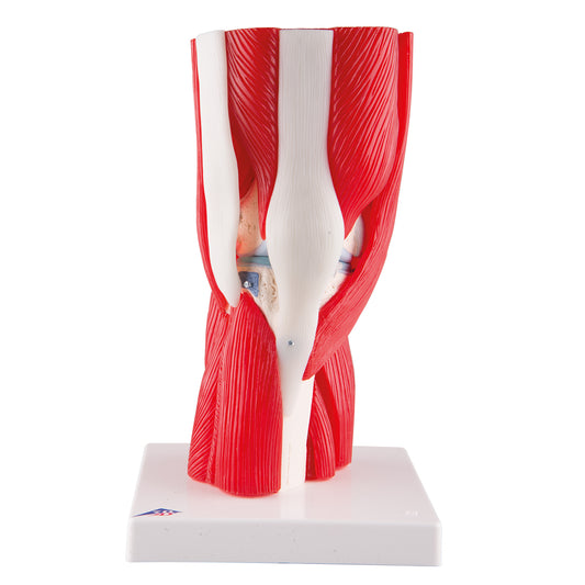 Knee  Joint  12-Part A882