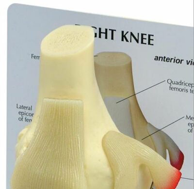 Knee Basic G100 2