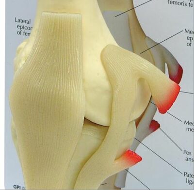 Knee Basic G100 3