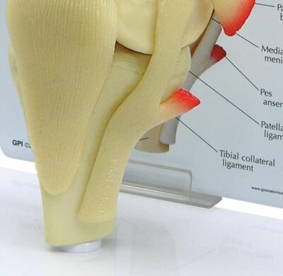 Knee Basic G100 4