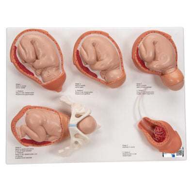 Labor Stages Model 1