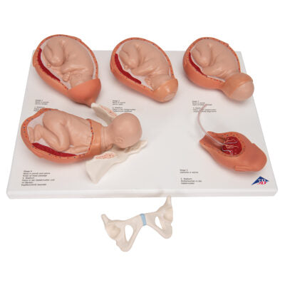 Labor Stages Model 4