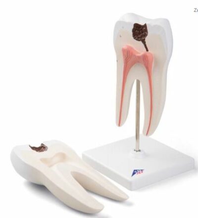 Lower Twin-Root Molar Showing  D10/4 3