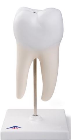 Lower Twin-Root Molar Showing  D10/4