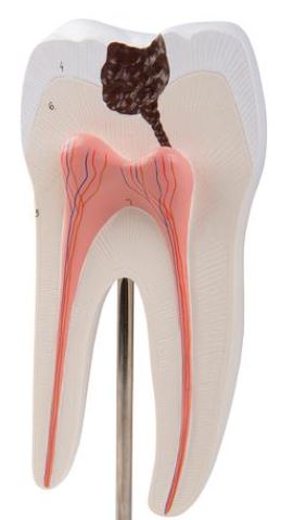 Lower Twin-Root Molar Showing  D10/4 1