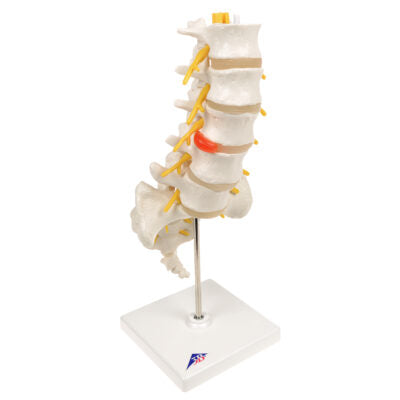 Lumbar Spinal Column w. Dorso-Lateral  A76/5 1