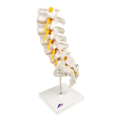 Lumbar Spinal Column w. Dorso-Lateral  A76/5 2