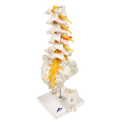 Lumbar Spinal Column w. Dorso-Lateral  A76/5 3