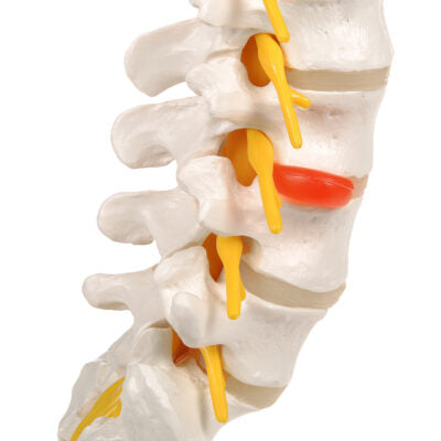 Lumbar Spinal Column w. Dorso-Lateral  A76/5 4