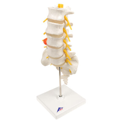 Lumbar Spinal Column w. Dorso-Lateral  A76/5 5