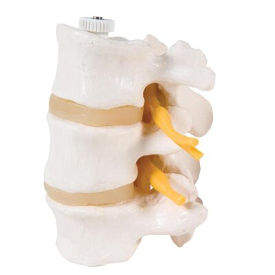 Lumbar Vertebrae 3 Part  Flexibly Mounted  A76/8 1