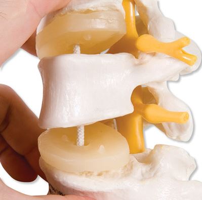 Lumbar Vertebrae 3 Part  Flexibly Mounted  A76/8 3