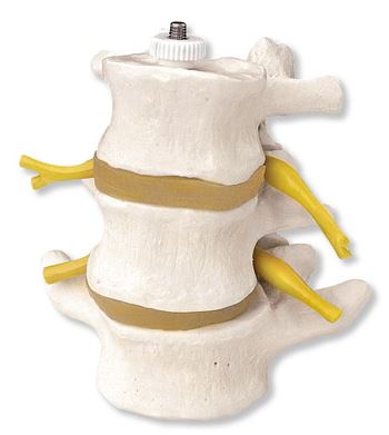 Lumbar Vertebrae 3 Part  Flexibly Mounted  A76/8 2