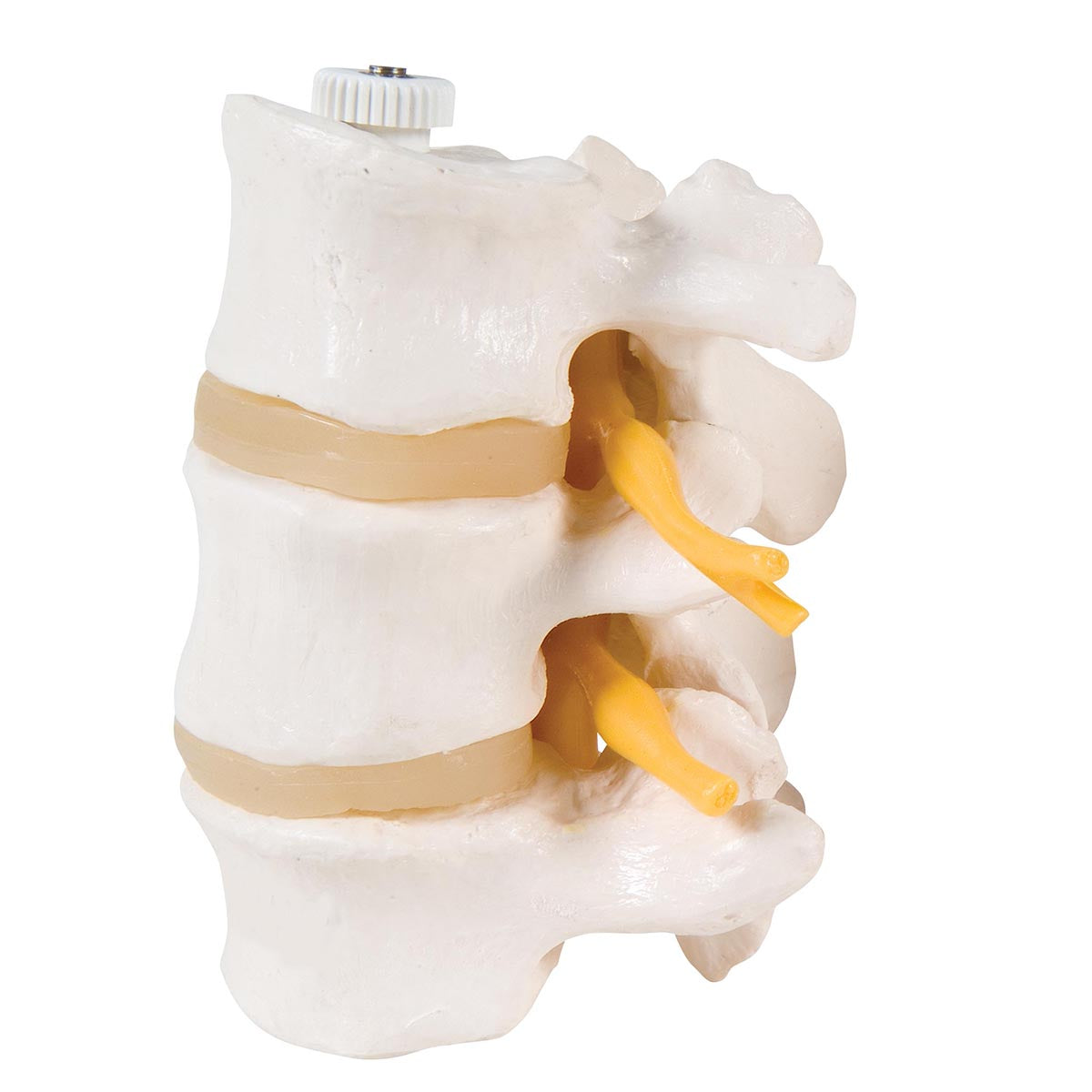Lumbar Vertebrae 3 Part  Flexibly Mounted  A76/8