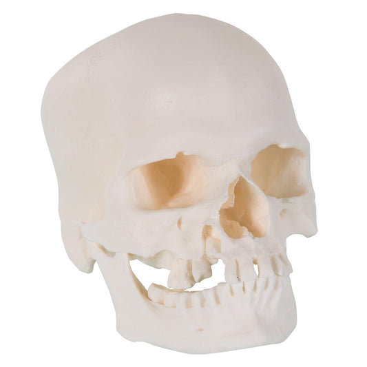 Microcephalic Skull A29/1