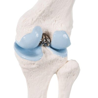 Mini Knee Joint with Cross Section A85/1 2