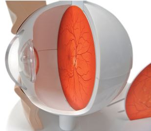 Pathological Eye  F17 3