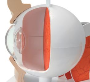 Pathological Eye  F17 2