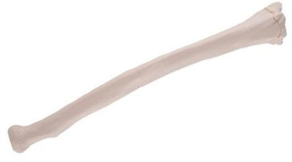 Radius A45/3