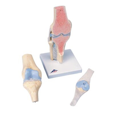 Sectional knee Joint Model A89 1