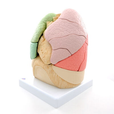Segmented Lung  G70 4