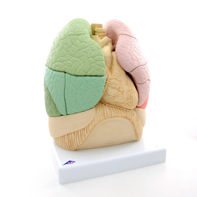Segmented Lung  G70 1