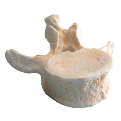 Set of 5 lumbar vertebrae A792 2