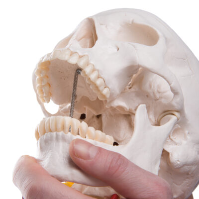 Skull on Cervical Spine  4 Part  A20/1 5