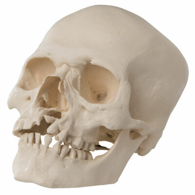 Skull with Cleft Jaw and Plate A29/3 1