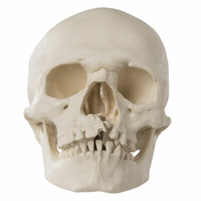 Skull with Cleft Jaw and Plate A29/3 2