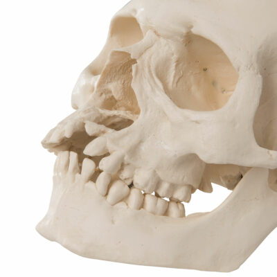 Skull with Cleft Jaw and Plate A29/3 3